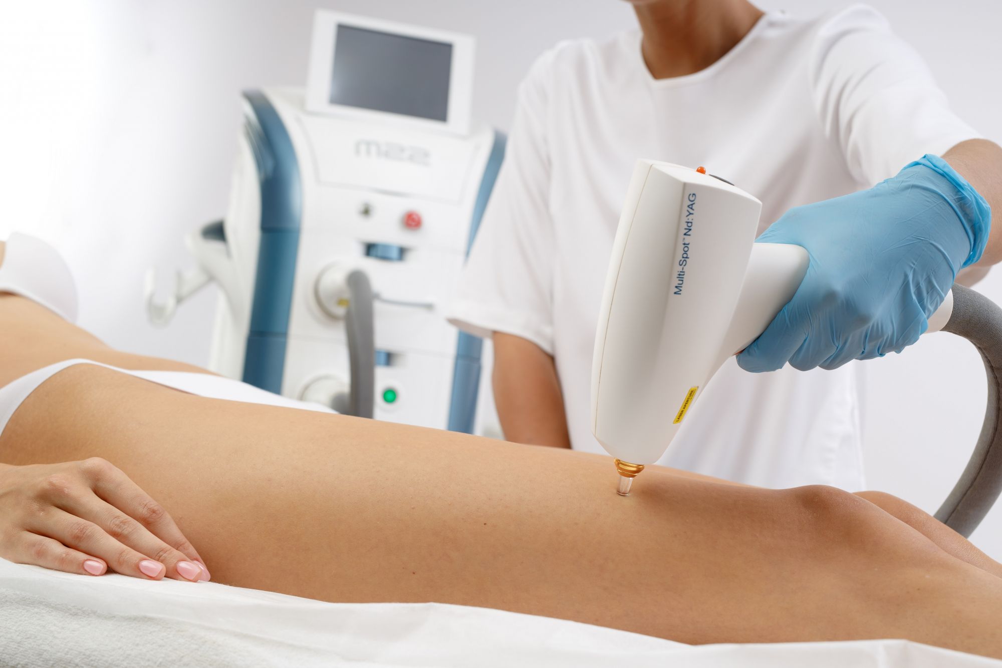 ЛАЗЕРНОЕ ЛЕЧЕНИЕ ВАРИКОЗА